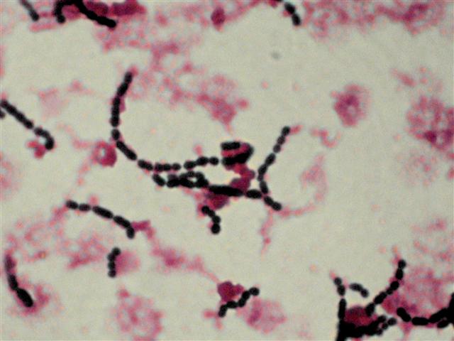 Group B Streptoccocus 9